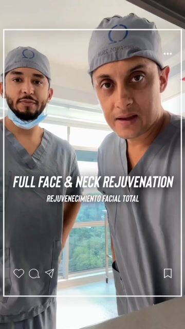 Transformación de lifting facial — video de antes y después de lifting facial