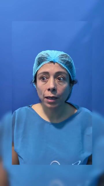 Transformación de lifting facial — video de antes y después de lifting facial
