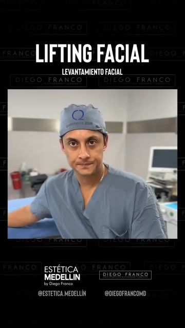 Transformación de lifting facial — video de antes y después de lifting facial